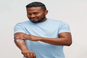 What You Should & Shouldn’t Do to Itchy Sunburn